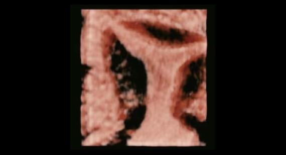 gynecologist-1.jpg gynecologist-1.jpg
