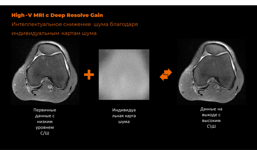 obzor_siemens_magnitom_freemax6.jpg